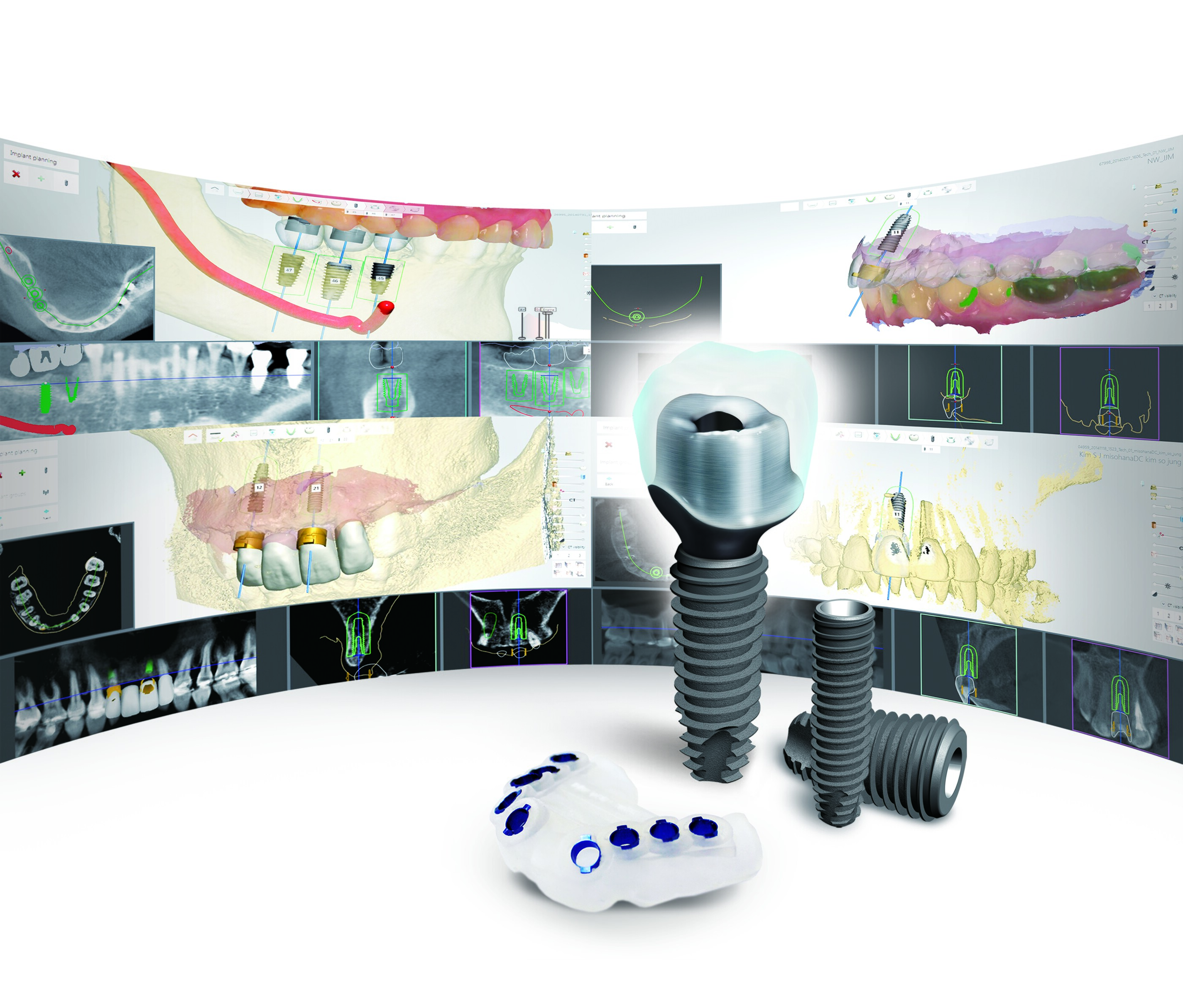 Digital Implant