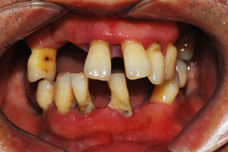 Case 1 Before