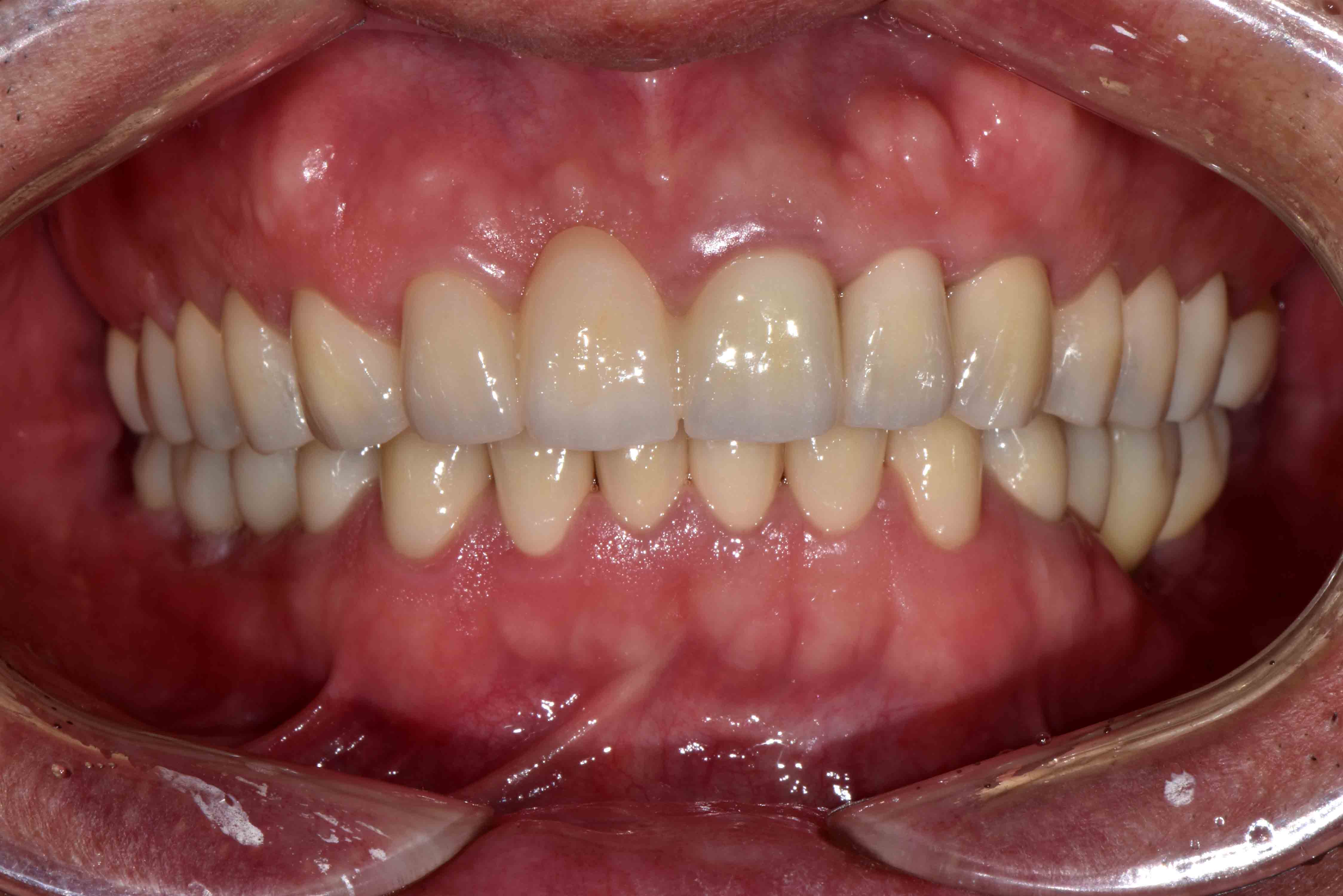 Case 2 After