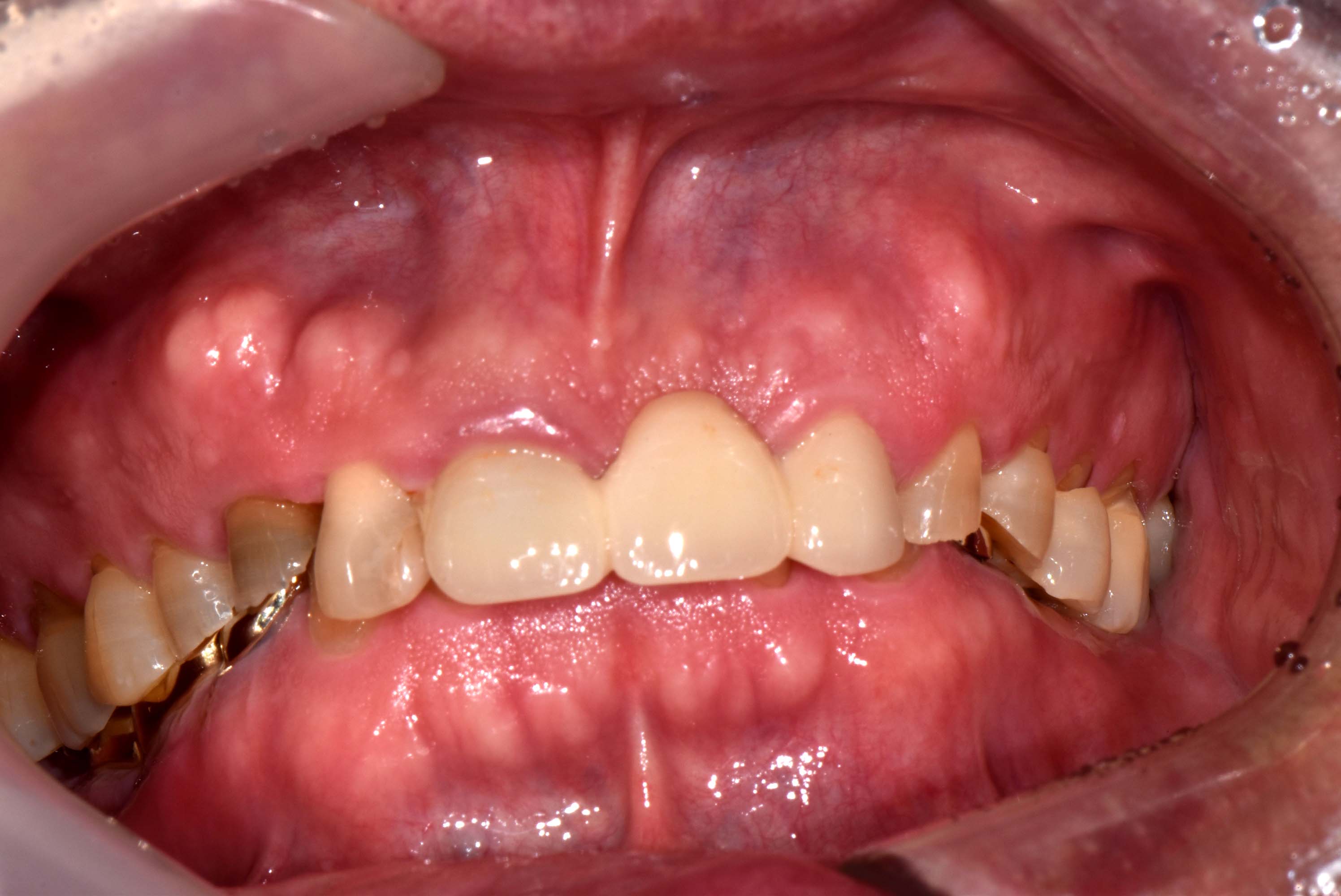 Case 2 Before