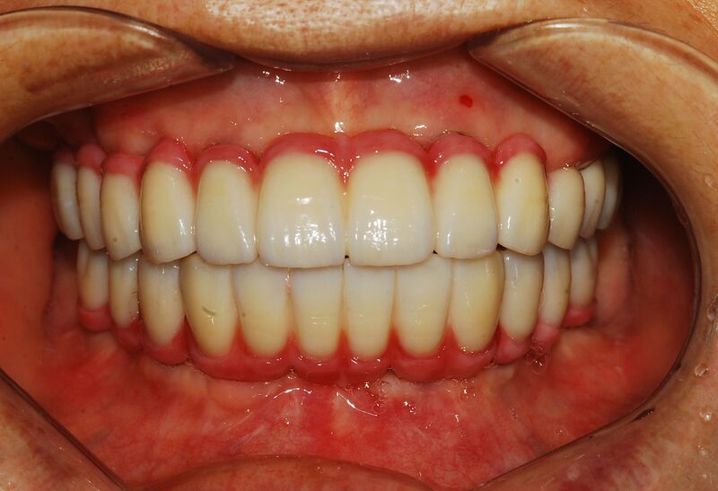 Case 3 After
