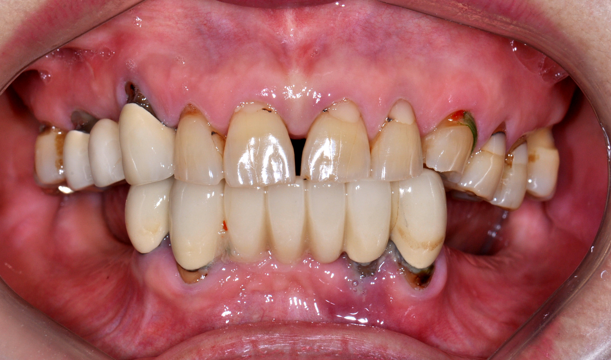 Case 3 Before