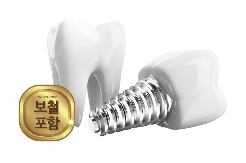 Implant